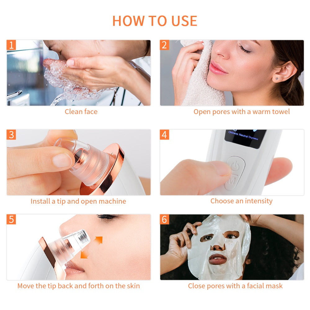 Blackhead Remover